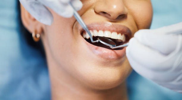 Best Dentist for Tooth Abscess  in Palmetto Estates, FL